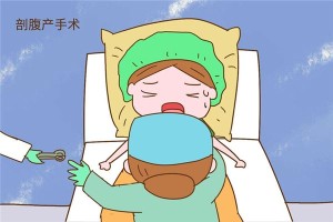怎样选择剖腹产的日子和时间