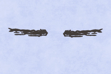 男人脸上哪个地方的痣不能点图片 手心上的痣不能点 男人脸上哪个地方的痣不能点图片 手心上的痣不能点